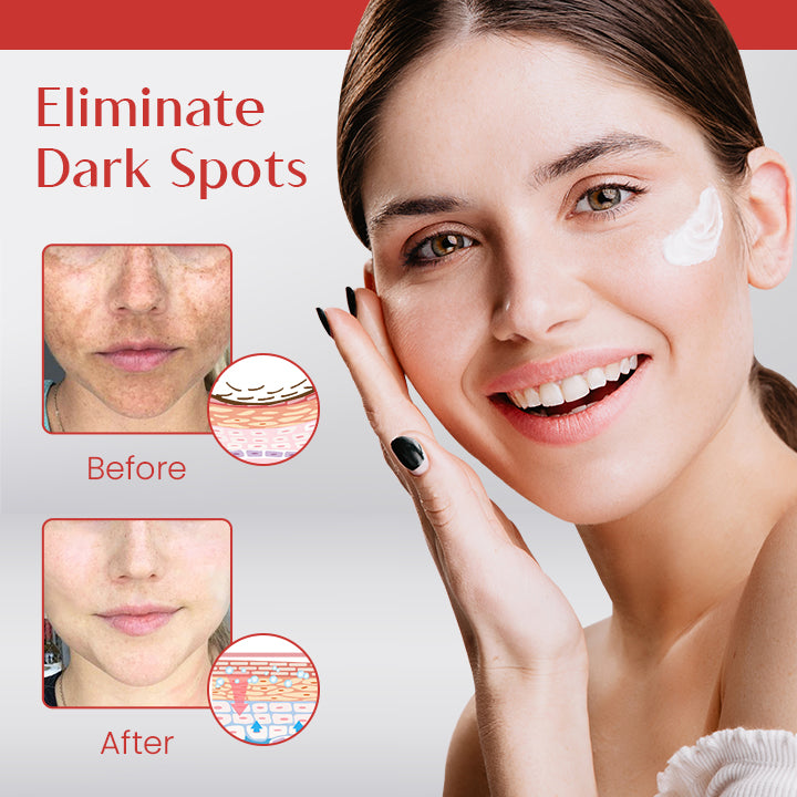 Ceoerty™ Spot Corrector Cream