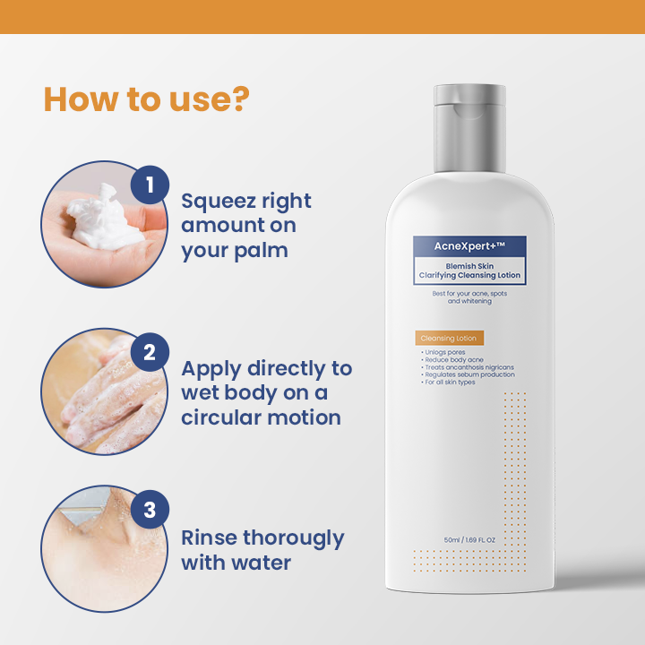 AcneXpert+™ Blemish Skin Clarifying Cleansing Lotion