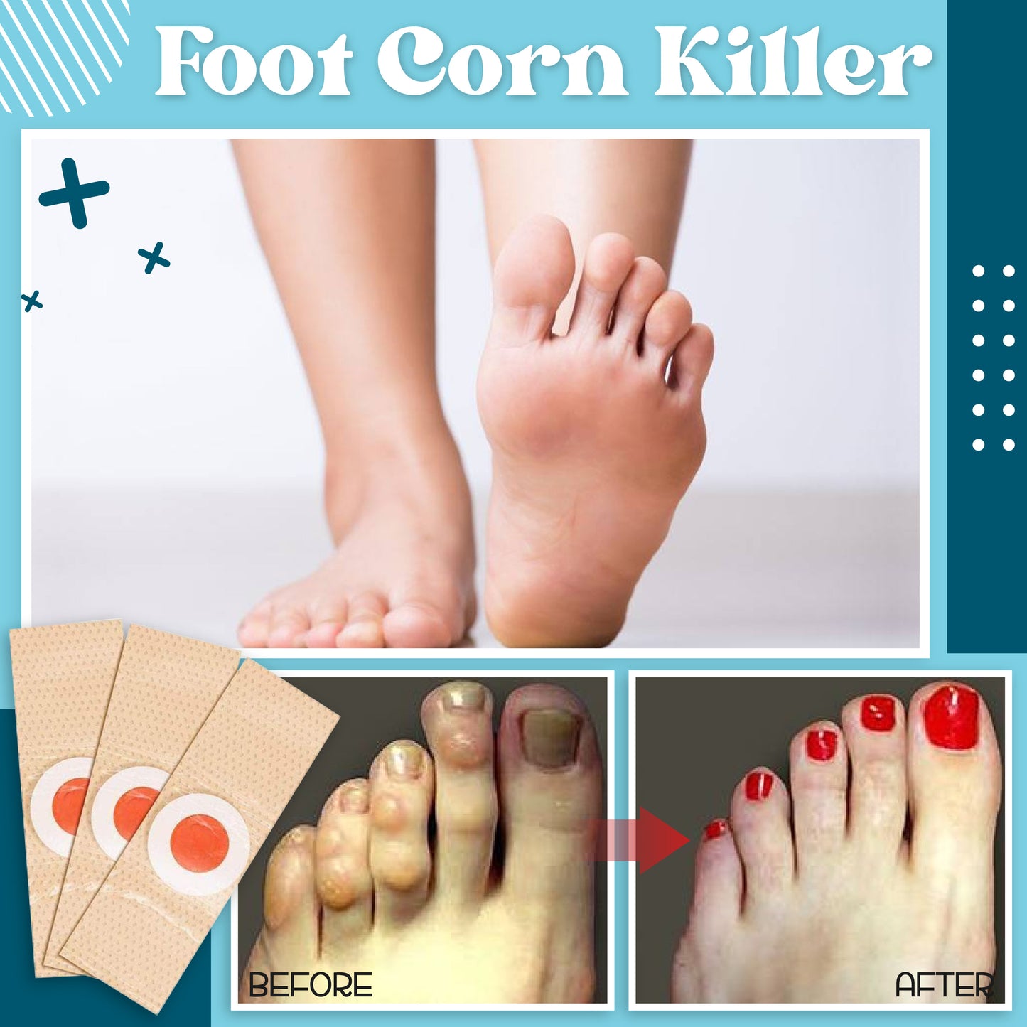 Foot Corn Killer (6pcs)