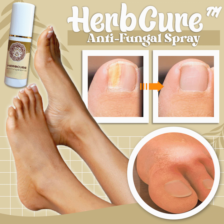 HerbCure™ Anti-Fungal Spray