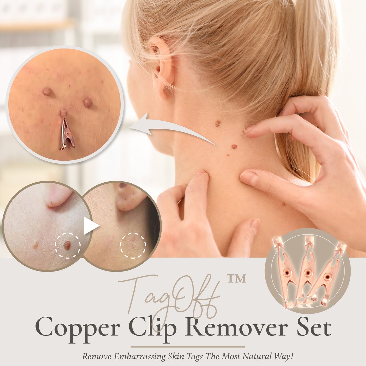 TagOff™ Copper Clip Remover Set (3pcs)