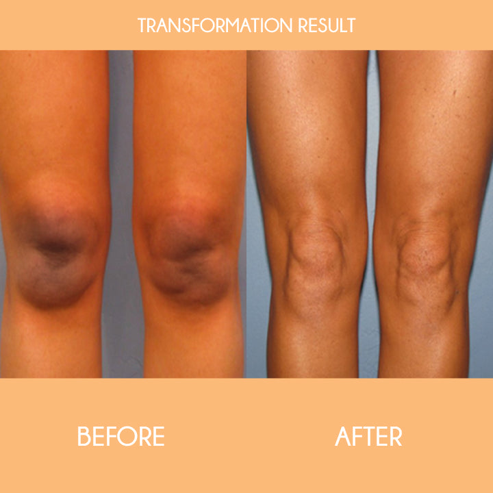 SkinRevive™ Orange Peeling Lotion