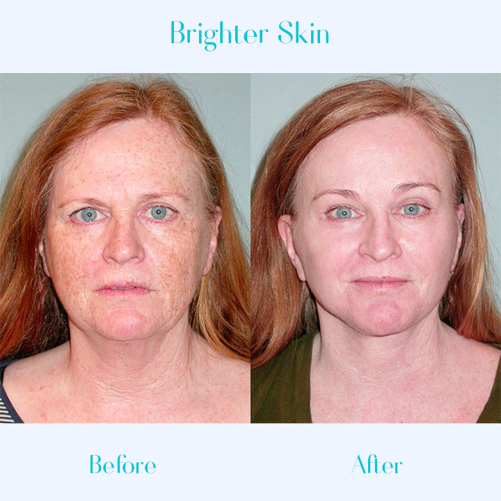 SKINPURE™ Dark Spot Corrector Cream