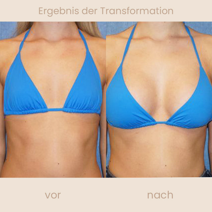 SIZEUP BustPlump Kräutermassage-Öl