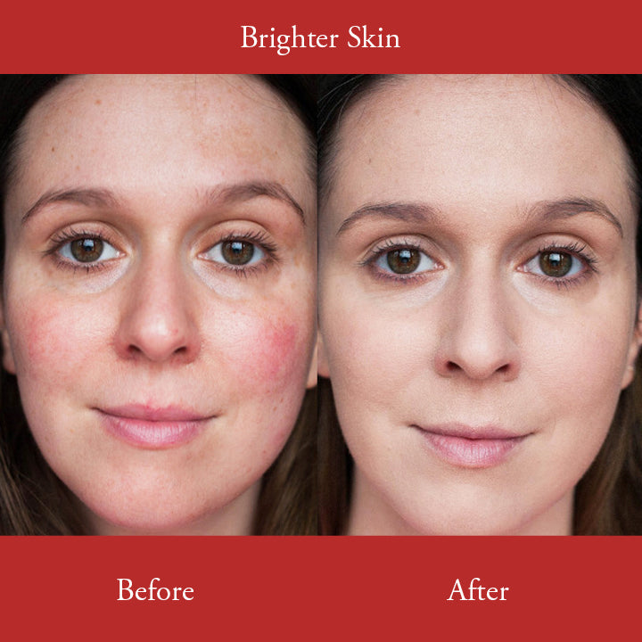 LUMINATE⢠Freckle Whitening Cream