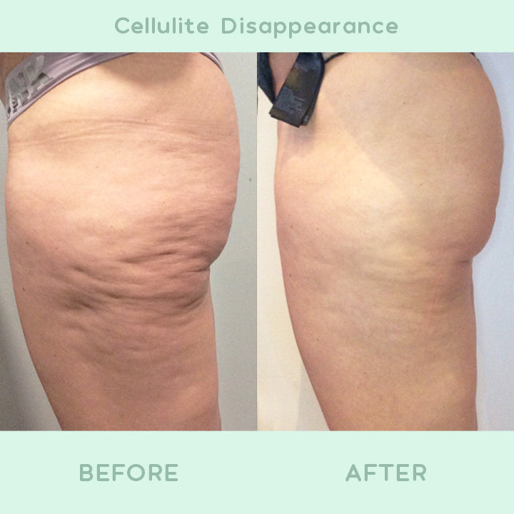 FirmSkin™ Tightening & Slimming Gel