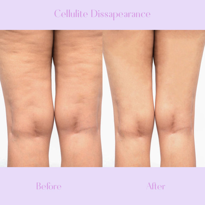 Fab&Firm™ Anti-Cellulite Slimming Soap