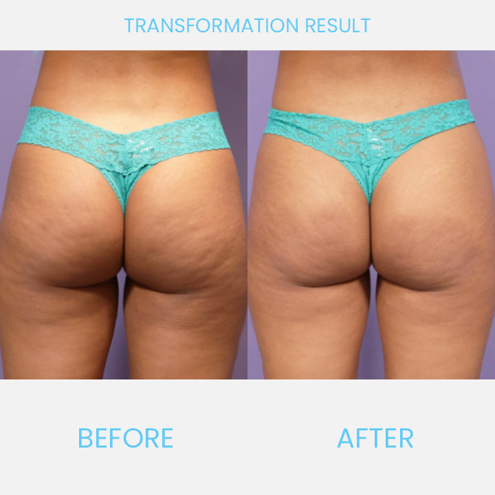 FirmSkin™ Tightening Essence Spray