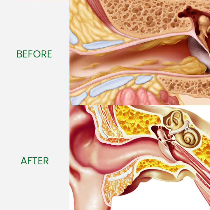 EarRelief™ Ringing Remedy Drop