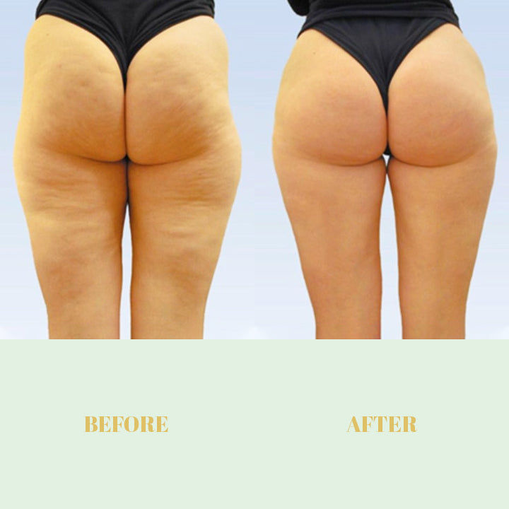 ButtUp™ Hip Lifting Essential Oil