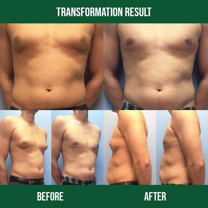 Fit+™ Anti-Gynecomastia Ointment