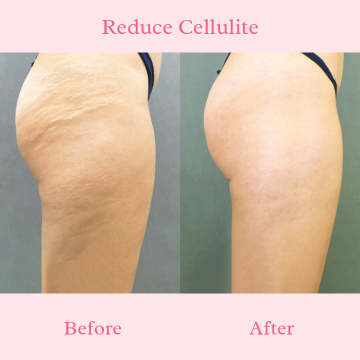 PeachyBum™ Hip Massage Cream