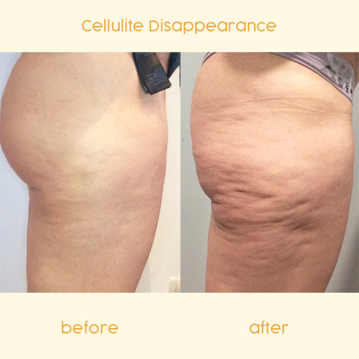 CELLUFIGHT™ Anti-Cellulite Slimming Cream