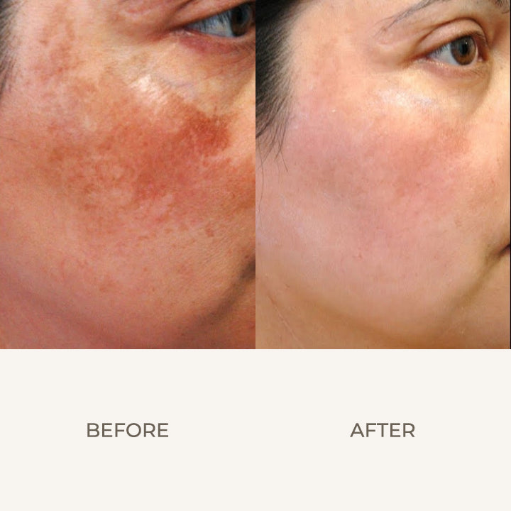 Skin Corrector Clarifying Serum