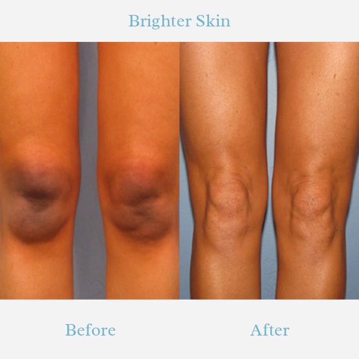GLOWHITE™ Body Care Brightening Cream