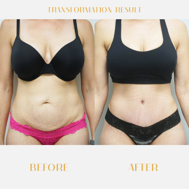 Beautify™ Anti-Cellulite Firming Soap