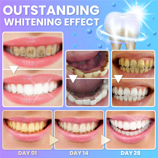 BrighTeeth™ Instant Whitening Foam Toothpaste