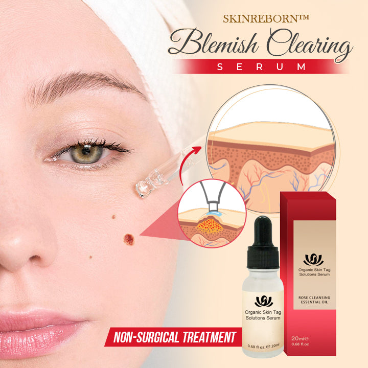 SkinReborn™ Blemish Clearing Serum