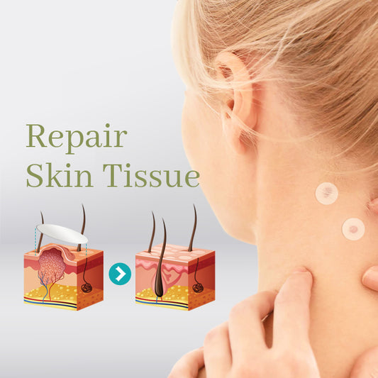 ProTag™ Skin Tag Remover Patches