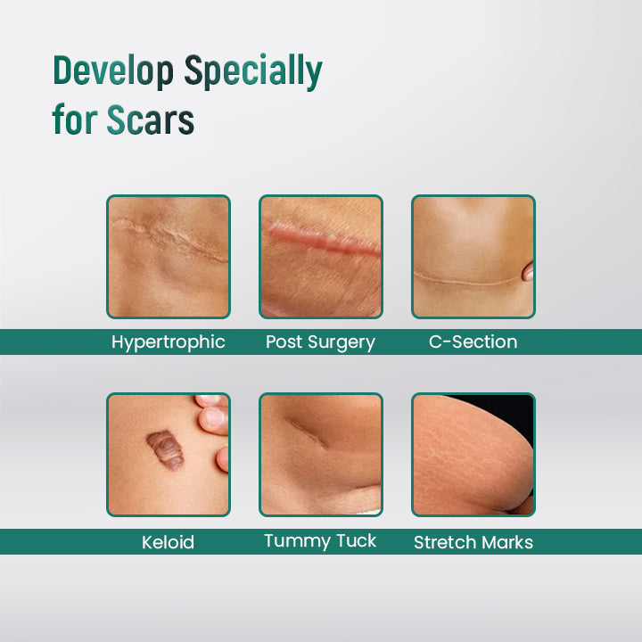 ScarXpert™ Advanced Scar Removal Gel