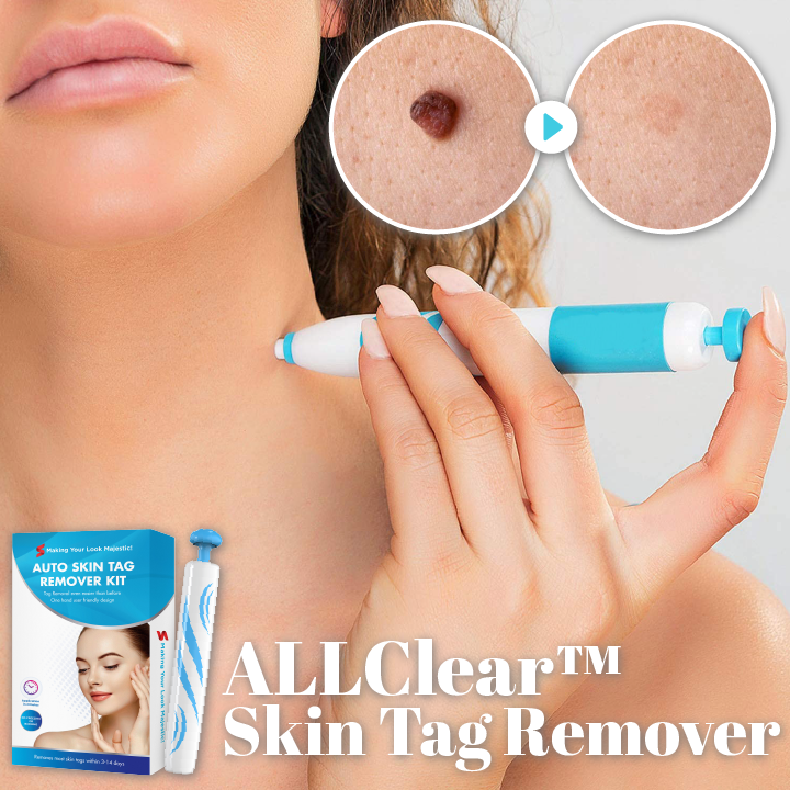 ALLClear™ Skin Tag Remover