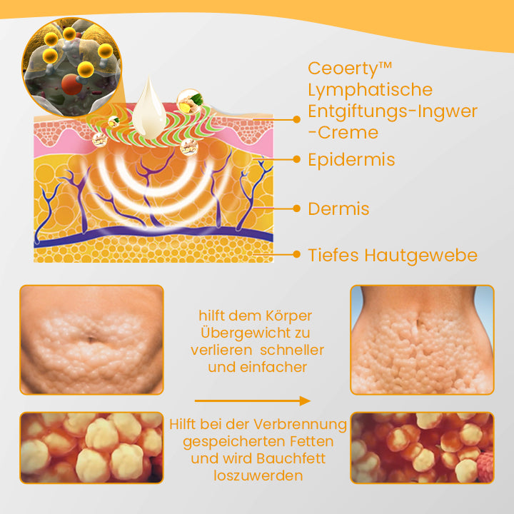 Ceoerty™ Lymphatische Entgiftungs-Ingwer-Creme