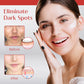 Ceoerty™ Spot Corrector Cream