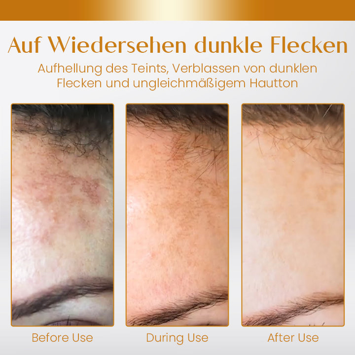 Ceoerty™ Feuchtigkeitsspendendes & Peeling Haut Öl