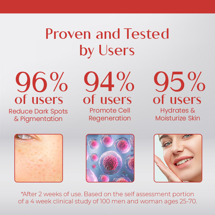 Ceoerty™ Spot Corrector Cream