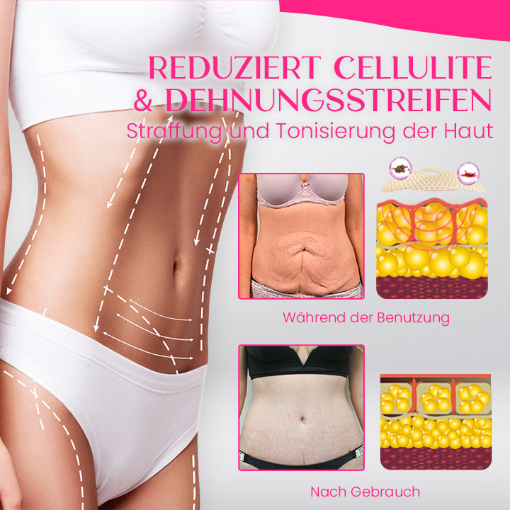 Ceoerty™ Bauchschlankheitspflaster
