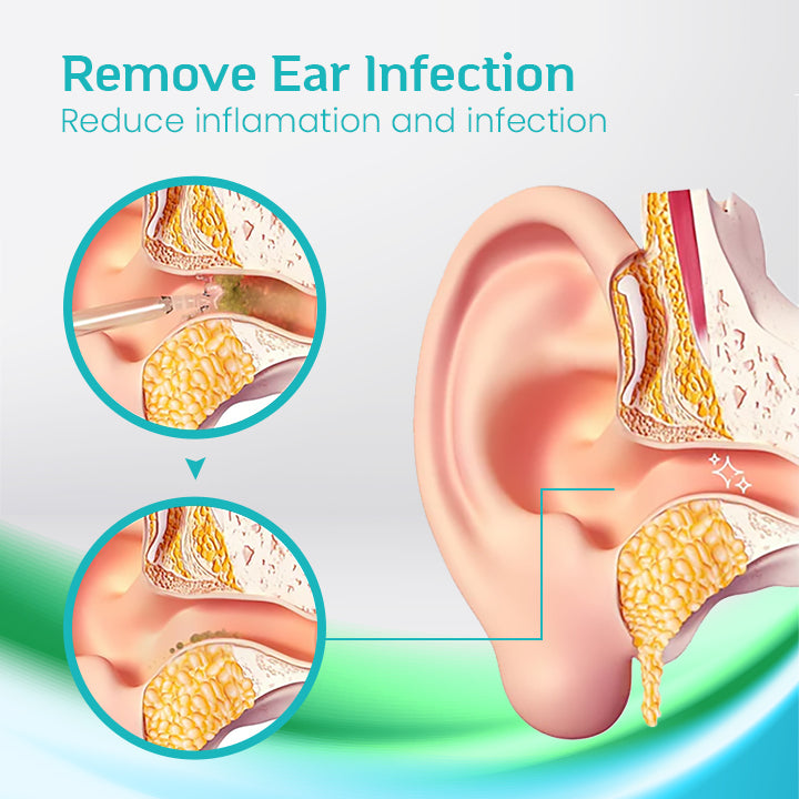 Ceoerty™ Ear Ringing Remedy Oil