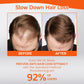 Ceoerty™ Roll-On Hair Regrow Treatment