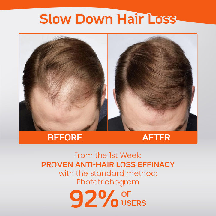 Ceoerty™ Roll-On Hair Regrow Treatment