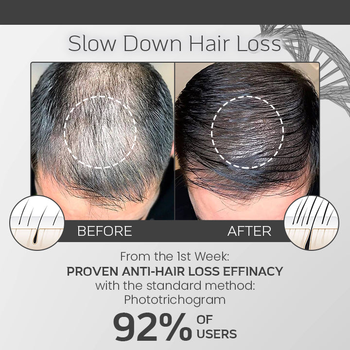 Ceoerty™ Hair Loss Defense Spray