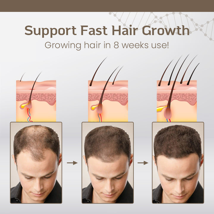Ceoerty™ Hair Regrowth Treatment Spray