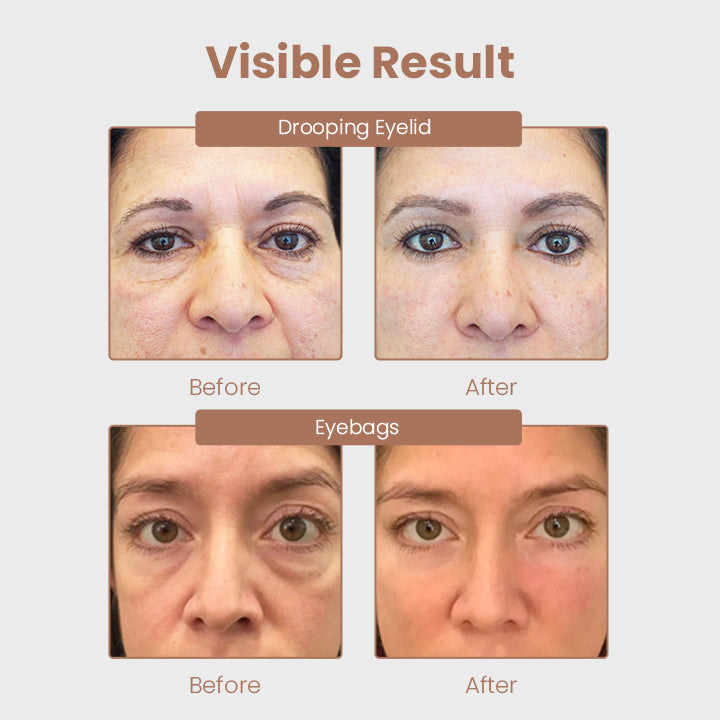 Ceoerty™ Caffeine Repair & Lifting Eye Cream