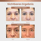 Ceoerty™ Koffein-Reparatur- und Lifting-Augencreme