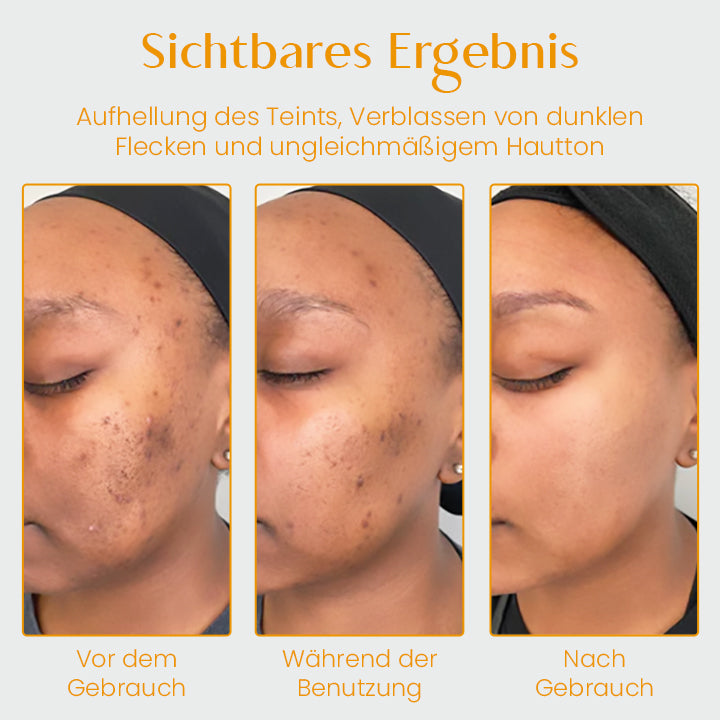 Ceoerty™ PRO-C Aufhellende Seife