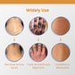 AcneXpert+™ Blemish Skin Clarifying Cleansing Lotion