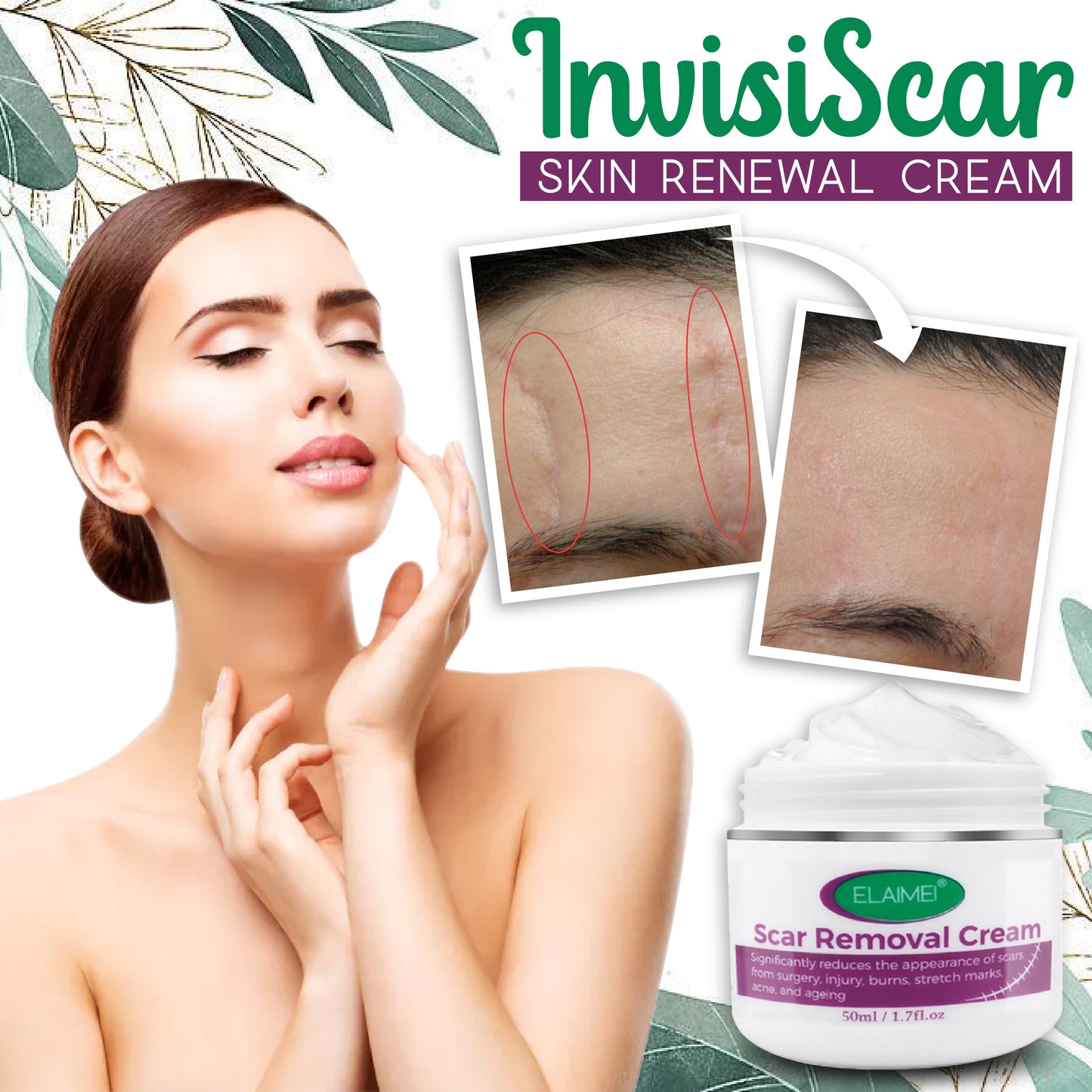 InvisiScar Skin Renewal Cream