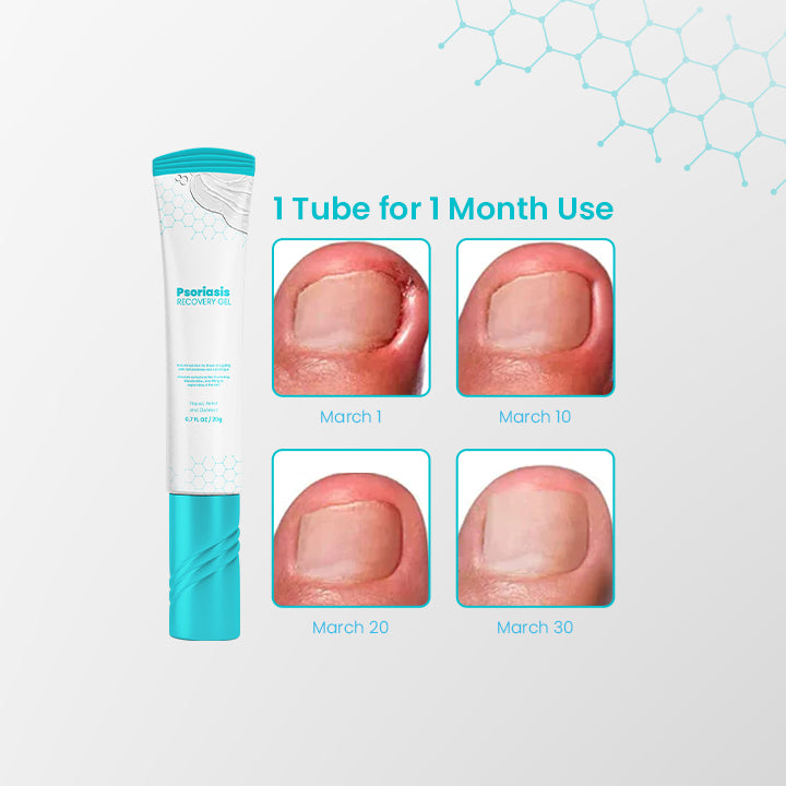 NailRevive™ Psoriasis Recovery Gel