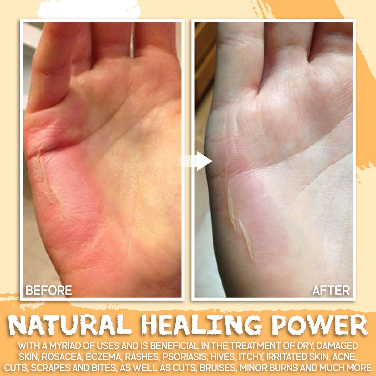 DERMO™ All-Purpose Healing Cream