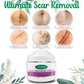 InvisiScar Skin Renewal Cream