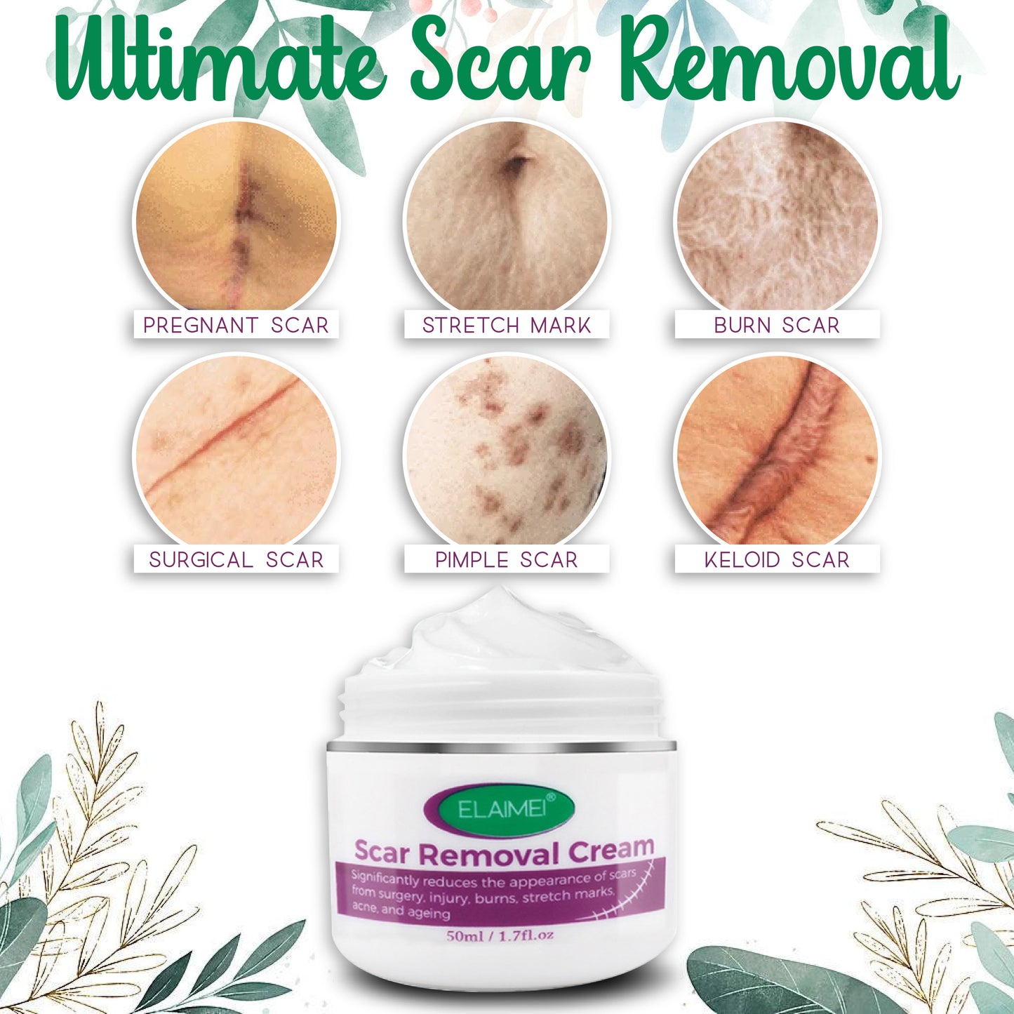 InvisiScar Skin Renewal Cream