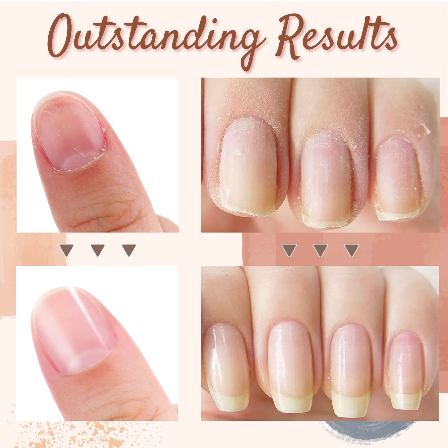 Nail & Cuticle Repair Oil Pen
