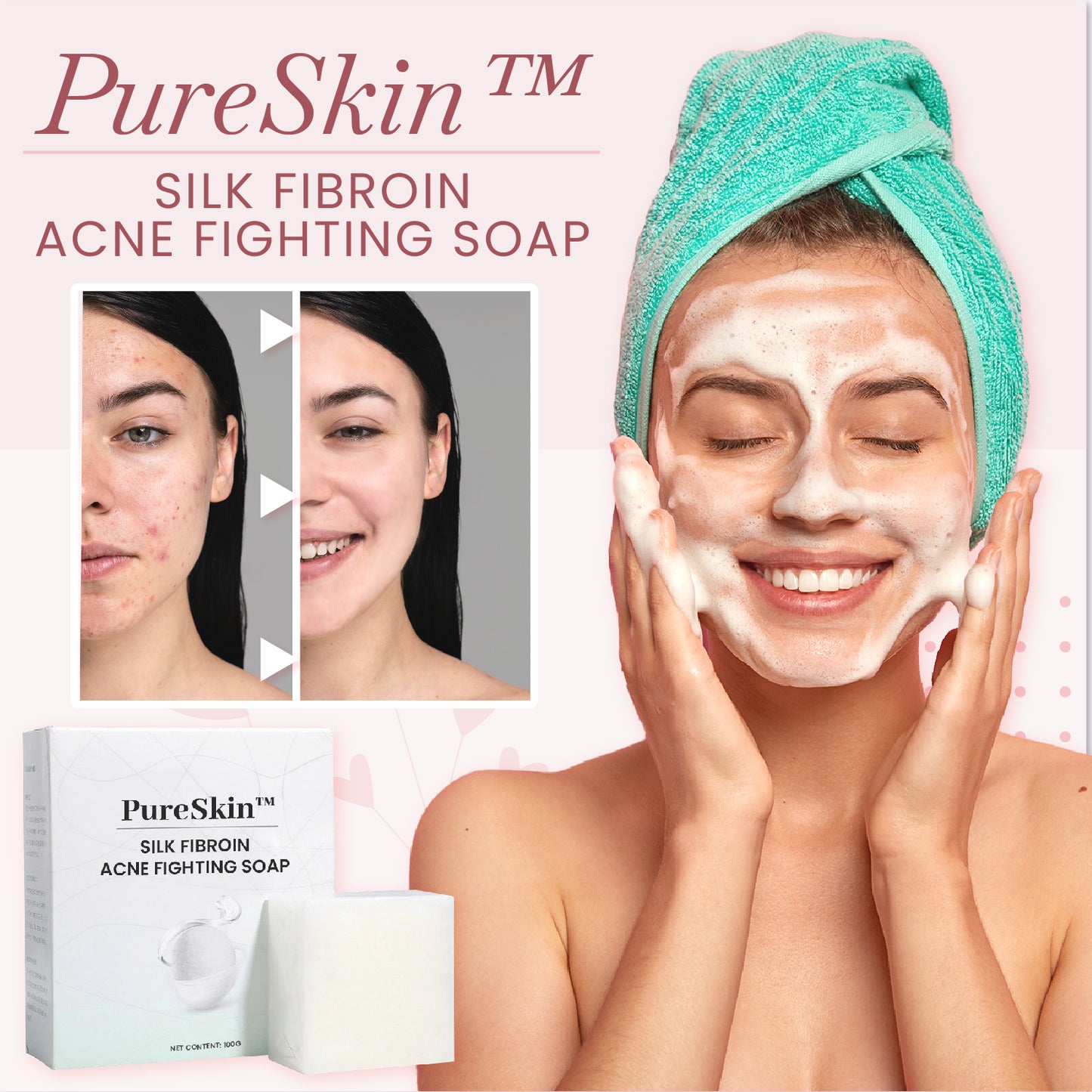 PureSkin™ Silk Fibroin Acne Fighting Soap