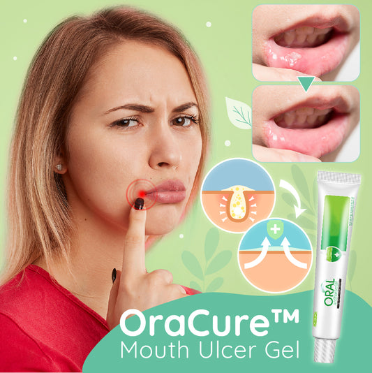 OraCure™ Mouth Ulcer Gel