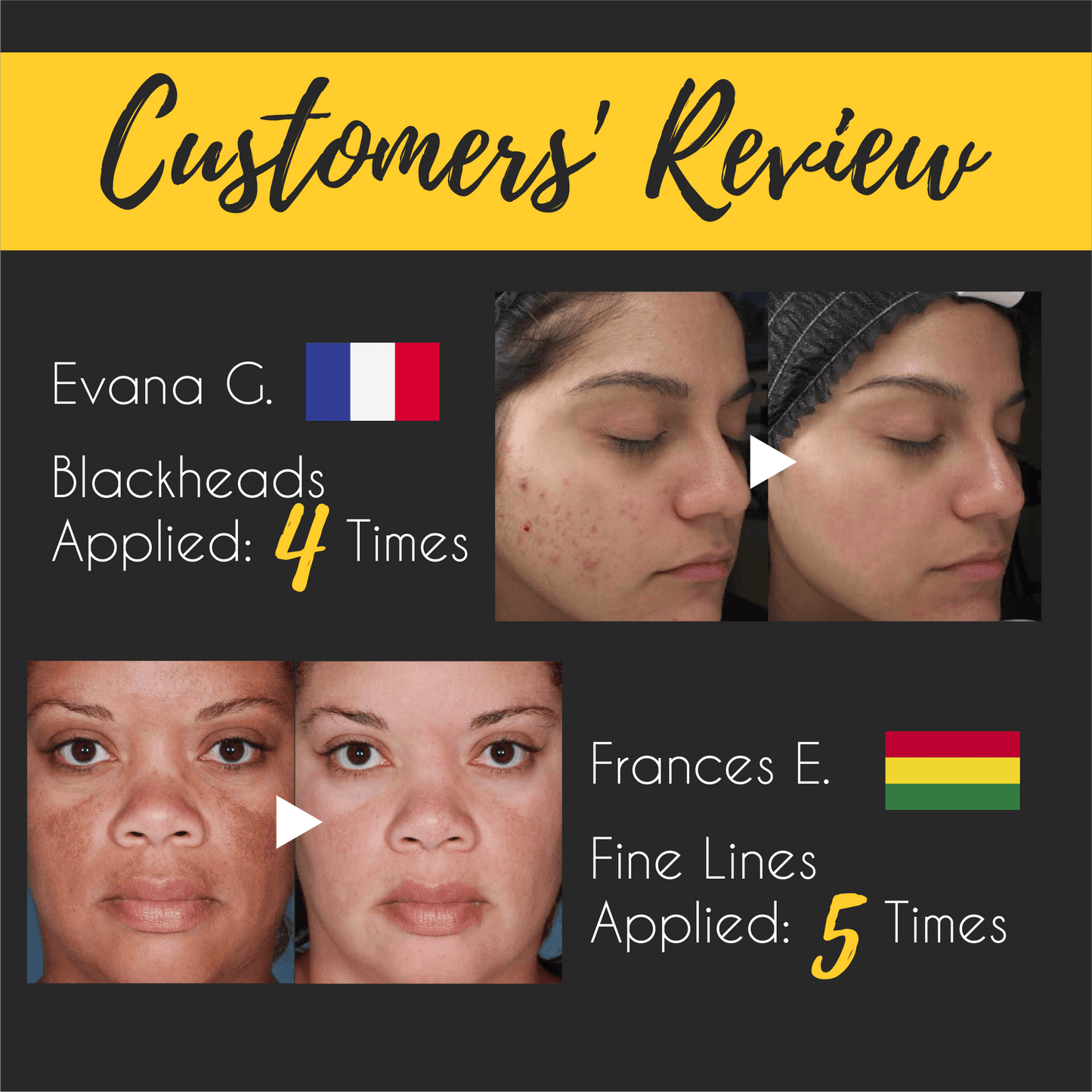 24K Gold Rejuvenating Peel Off Mask