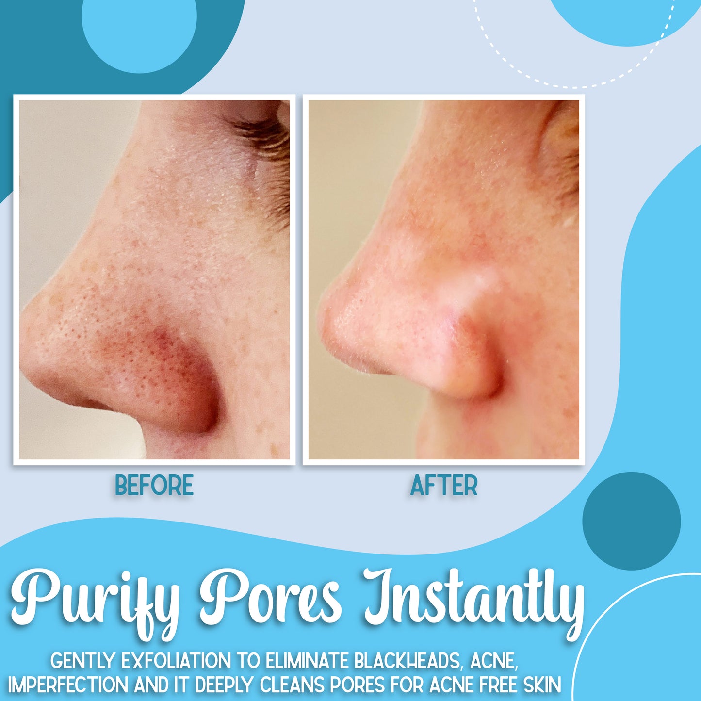 Poreless™ Icy Cool Hydrating Mask