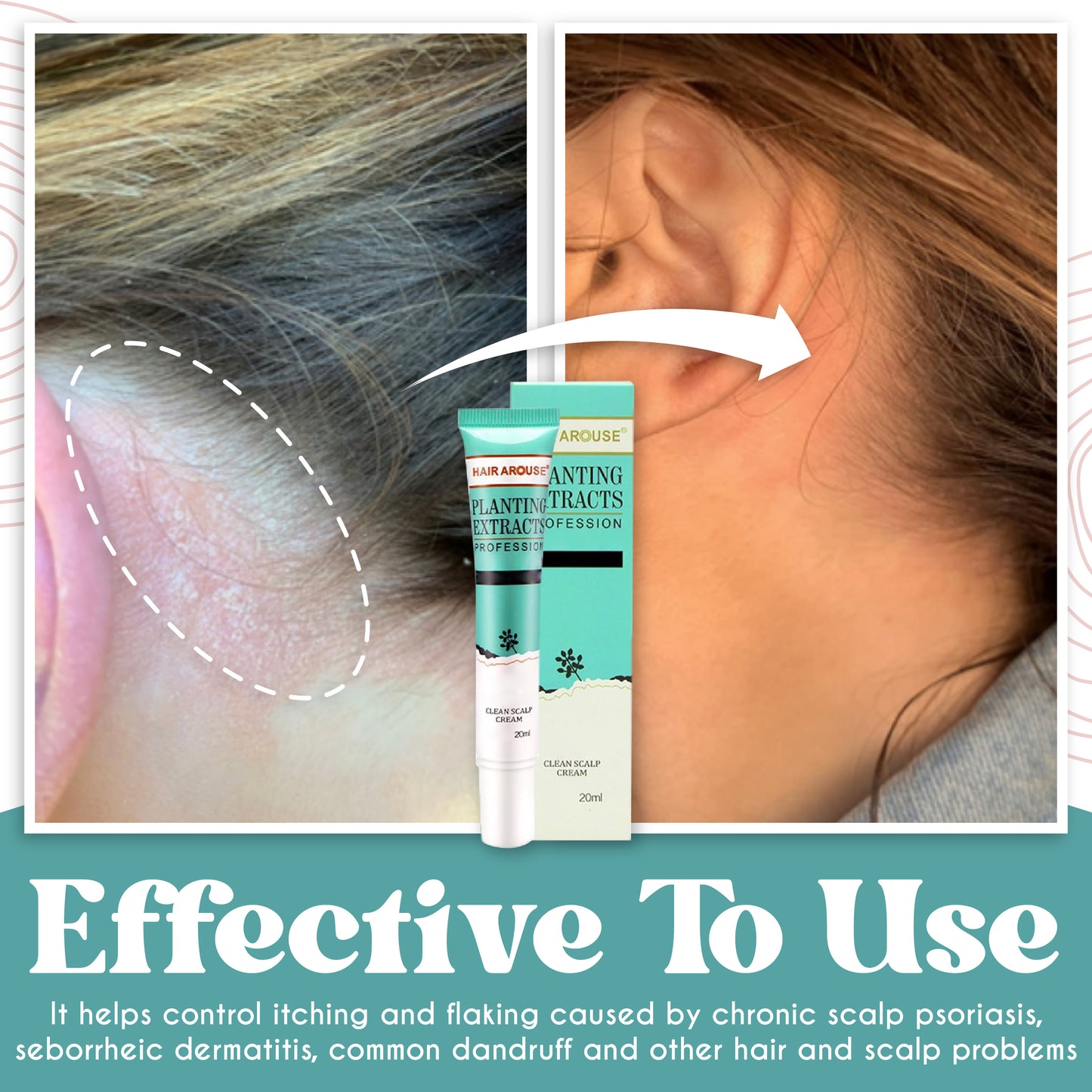 HairRescue™ Follicle Repair & Boost Serum